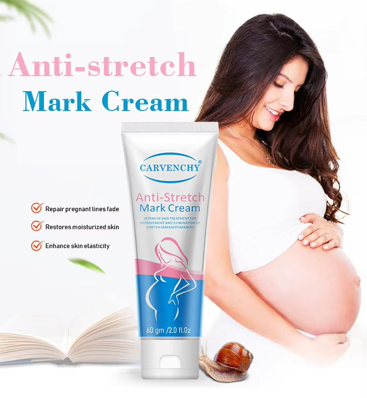 Anti-Stretch Mark Cream - Intensive Skin Treatment (60gm)